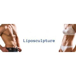 Liposculture